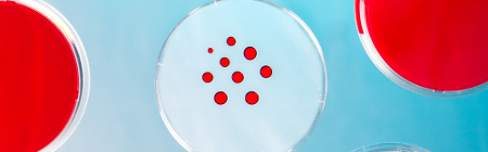 Petri dish with fungus